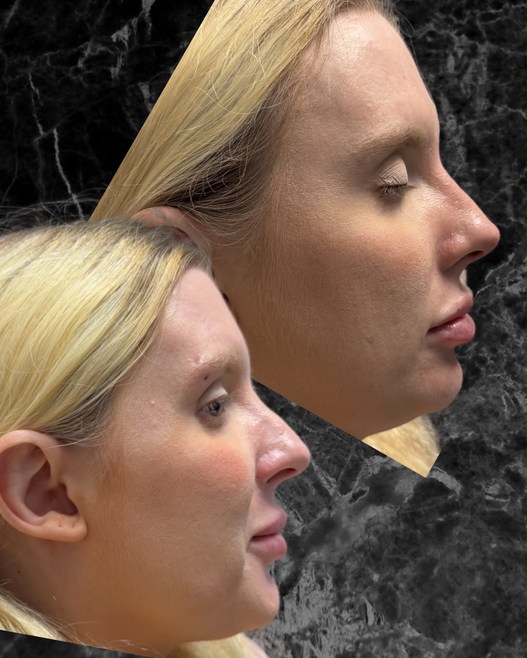 Client side profile assessment for injectable treatment planning